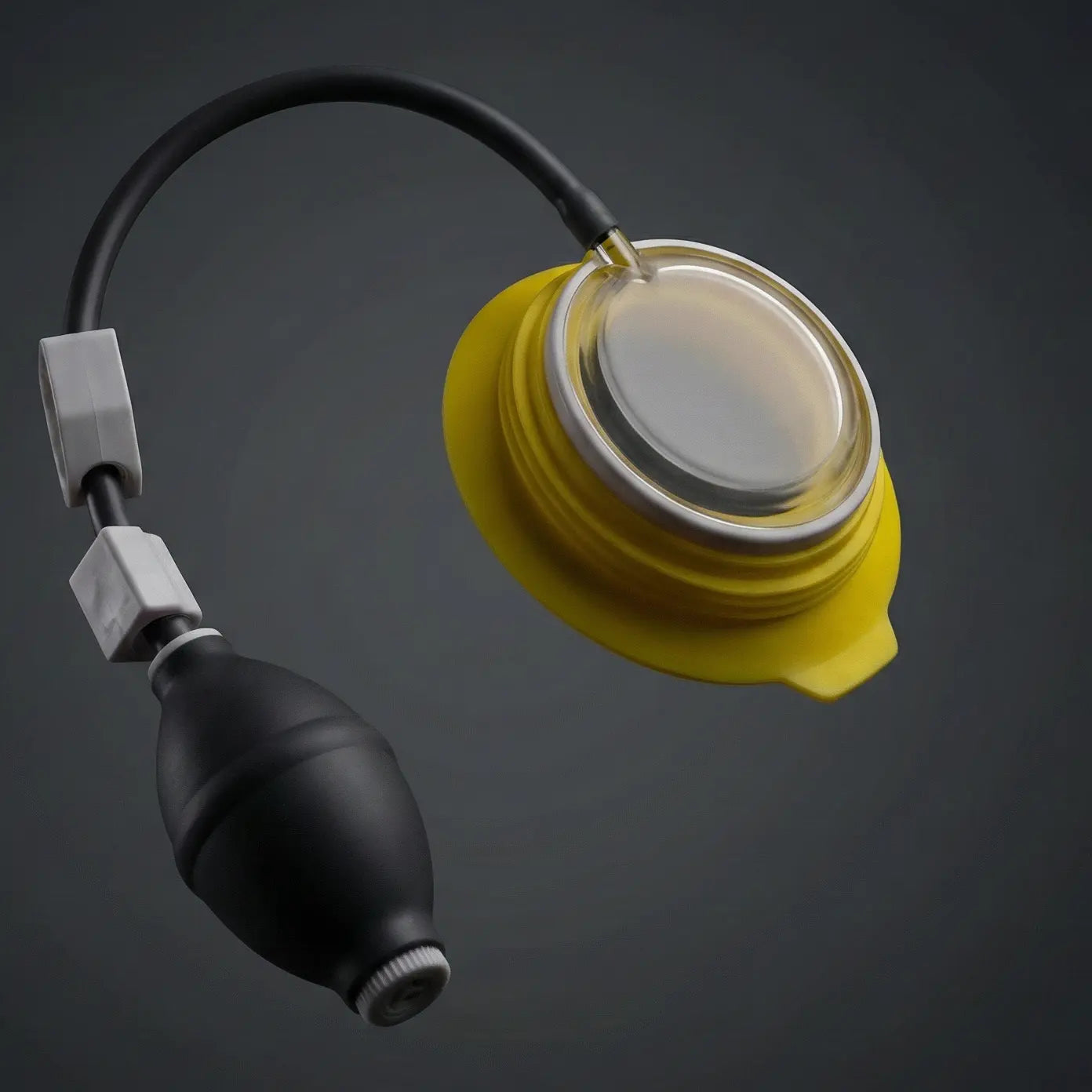 Pectus Excavatum Bell Forma Chest