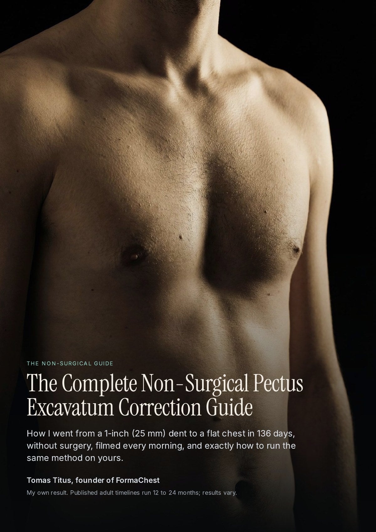 The Complete Non-Surgical Pectus Excavatum Correction Guide